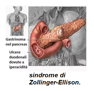 Il protettore dello stomaco 03 